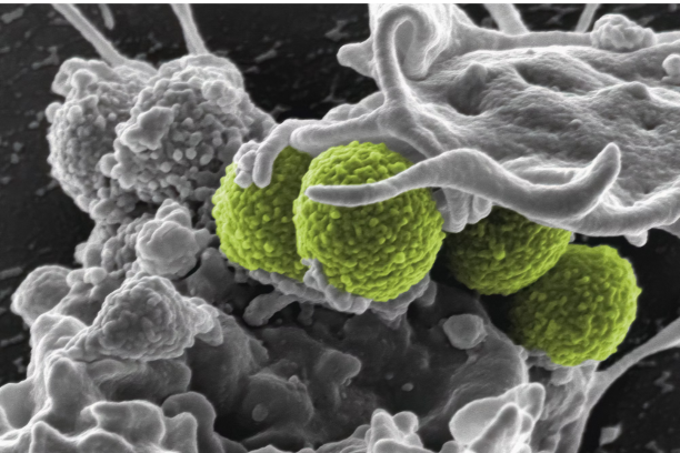 "gut microbiome structure showing good vs bad bacteria balance (UK 2025)"