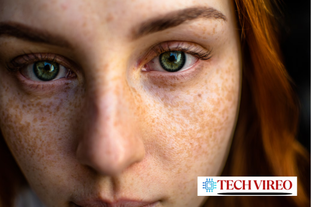 “Illustration of gut-skin axis showing how microbiome affects acne and eczema in 2025”